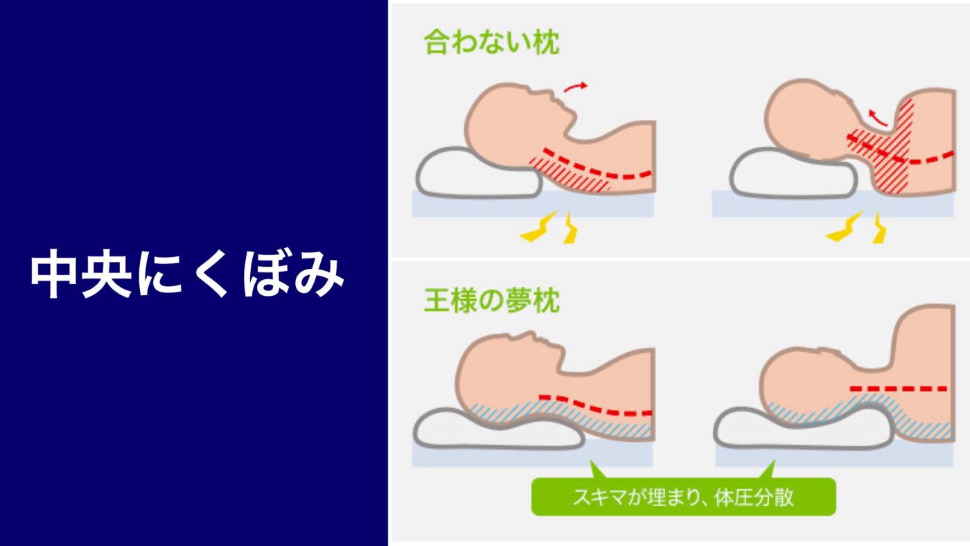 王様の夢枕の口コミ評判 デメリット 合わない人 みんかつ